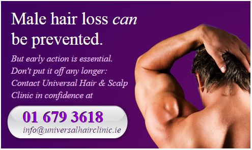 Minoxidil - Benefits & Side Effects - Hair Loss & Alopecia Treatment -  Universal Hair Clinic Dublin