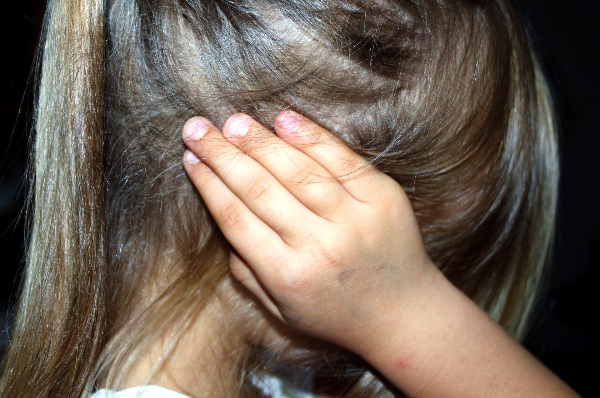 Why do women lose hair and what treatments there are