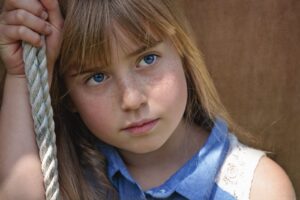 Alopecia in Children