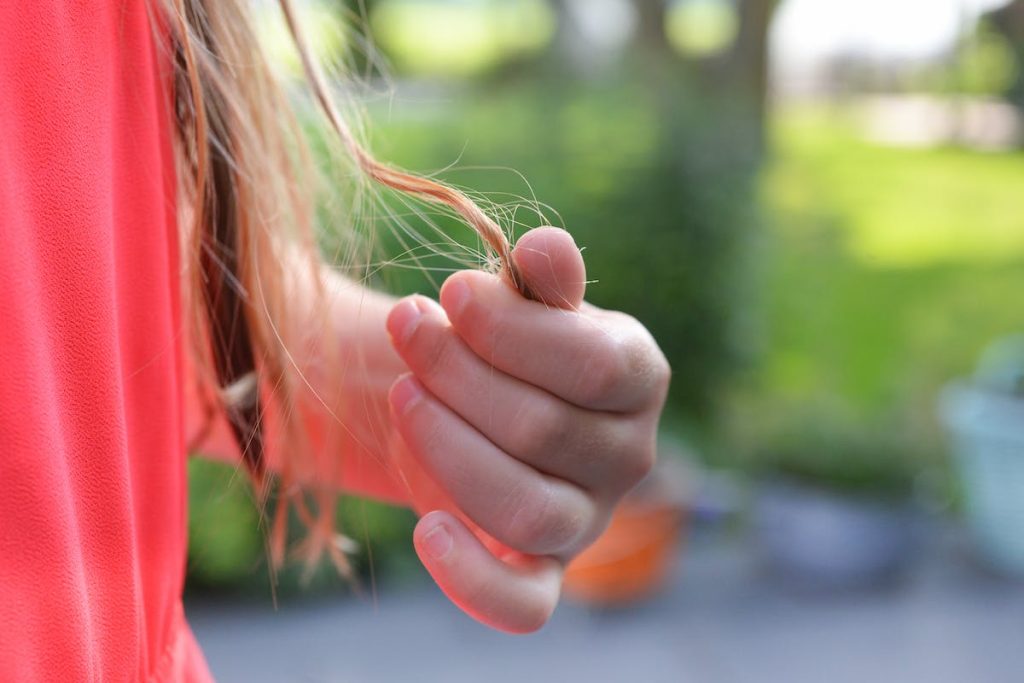 Female Pattern Hair Loss Why a Consultation With a Dublin Specialist Is Crucial 2