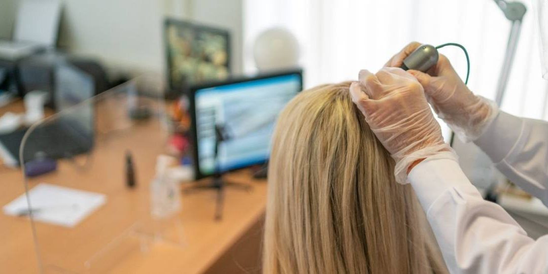 Why Visiting a Dublin Hair Loss Specialist Is Better Than Self-Treating