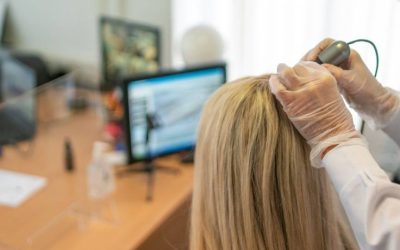 Why Visiting a Dublin Hair Loss Specialist Is Better Than Self-Treating