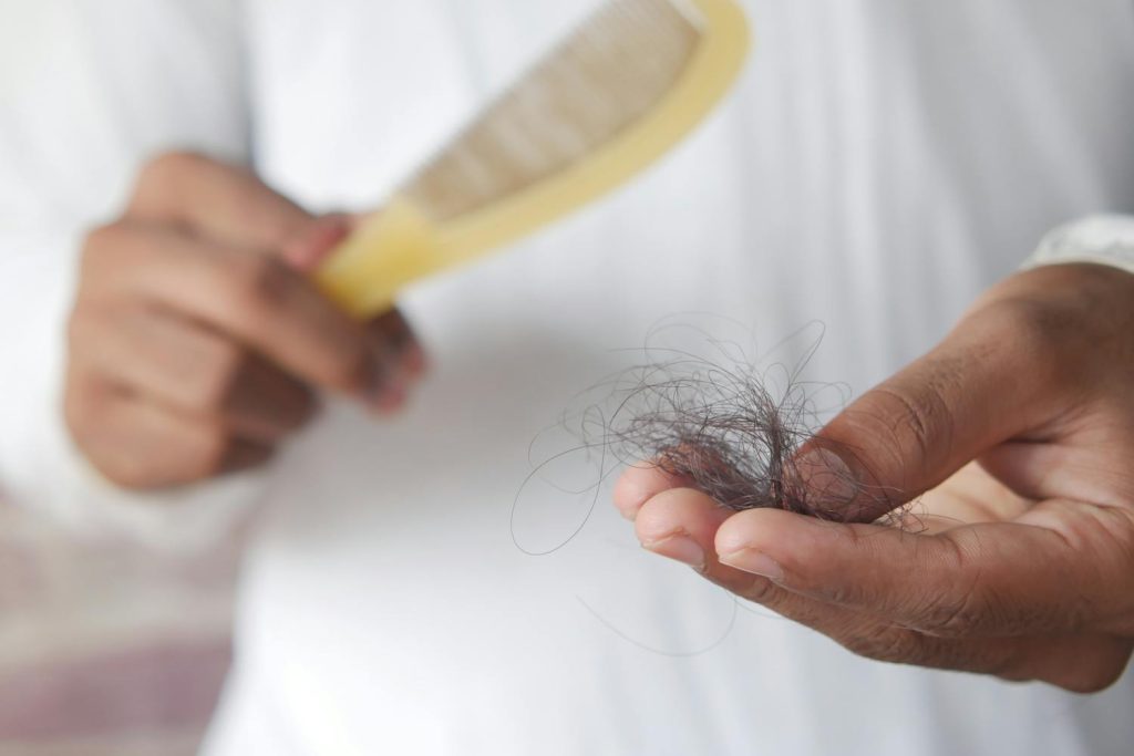Person holding a comb and a handful of shed hair, illustrating hair loss linked to scarring alopecia.