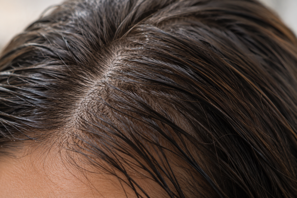 Close-up of damp hair and scalp showing hair lying flat due to humidity and excess moisture