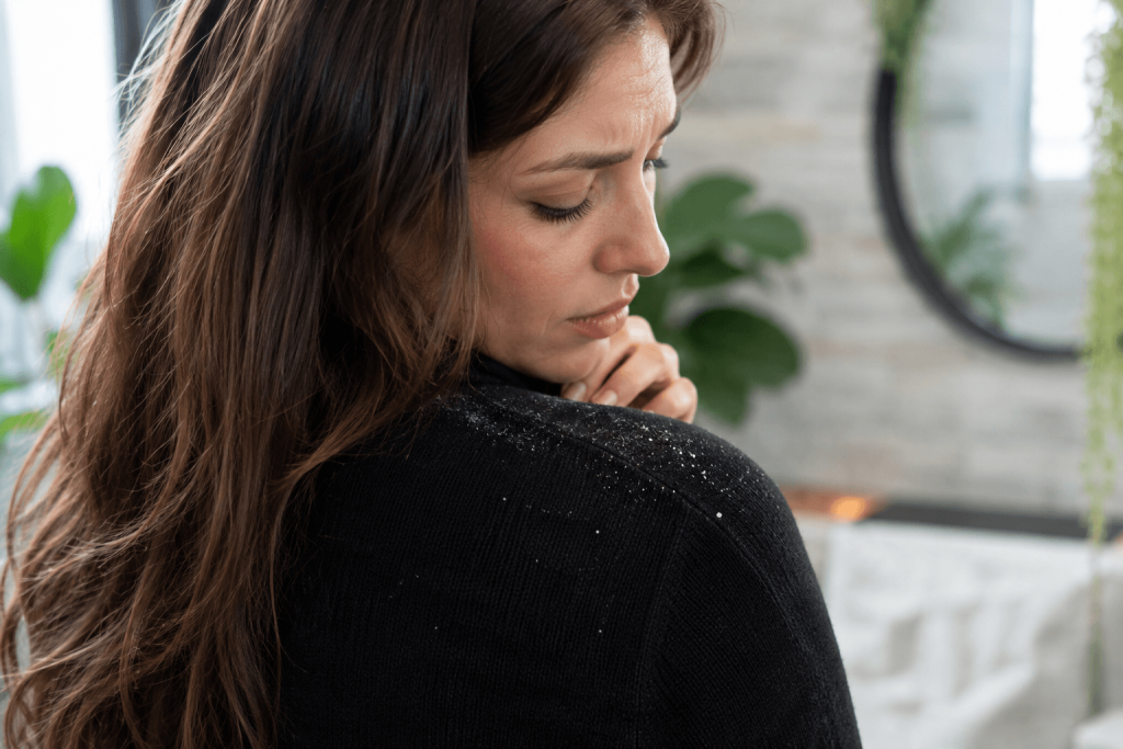 Woman looking at subtle flakes on her shoulder after noticing changes in her scalp